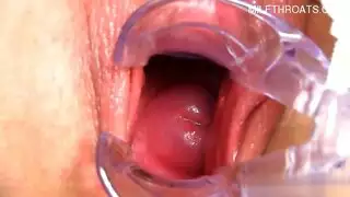 عمل متواصل بالهزاز على شفتيها المنتفختين